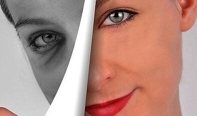 πώς να ανανεώσετε το δέρμα του προσώπου στο σπίτι